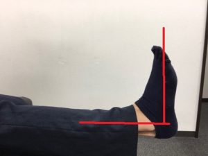 足首の柔軟性　異常
