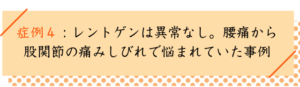 股関節の痛みの改善事例４